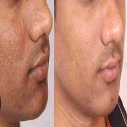 herbal-pure-product-9